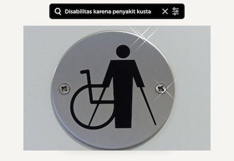 disabilitas karena kusta